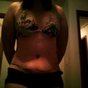 3 weeks post op with scar