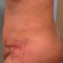 Side view - day 3.