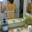 6 Days Post op
