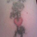 5 weeks after 1st treatment