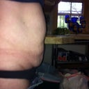 Yikes I haven't ever seen it from the side, ugh!