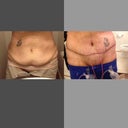 front before and after
