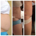 Before, at 2 wks and 3 wks