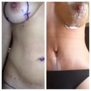 Before and After
