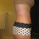 4 weeks- side