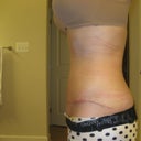 4 weeks- other side