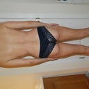 Back view the day before surgery