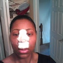 24 hours after surgery