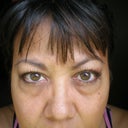 Before. No make up in natural lighting.