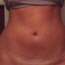 Exactly 8 weeks post- just started to notice it smoothing out :)