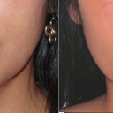 before and 12 weeks later