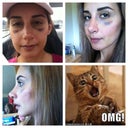 Day of cast removal