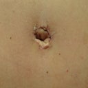 04/19/13-2 weeks-belly button close up