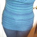 7 week post op, fully dressed