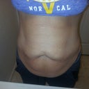 Abs relaxed.