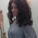 4 1/2 months after rhinoplasty