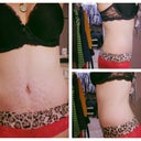 3 month mark... hopeful i continue to ease up on the love handles and that the scar tissue around the BB fades well.