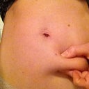 4,5 weeks. Noticing results :) The fat layer is definitely smaller. FYI: On all images where I pinch fat, I flex my stomach muscles to ensure that all I can pinch is the most superficial fat layer, so the images of the progress can be compared.
