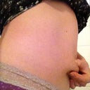 4,5 weeks side view - pinching fat. And this is my 'bigger' side. On the other side it is even harder to grab a roll when I'm standing tall and tighten the ab muscles.