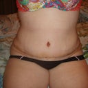 these pics were taken at night and swelling is worse at night