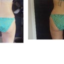 Day 12 left and Day 21 right comparison