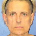 Before picture from surgeon 1
