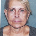 Before picture from surgeon who did my surgery