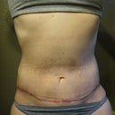 4 WK PO