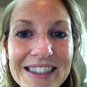 Right before treatment.   Bad smile lines and dark spots.