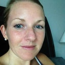 Ten days post treatment.  Loving the results!  No makeup!!!  So worth a few days of swelling!!