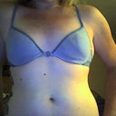 Before picture the day before surgery. I was 36-38 b.
