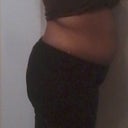 pre-op....could really use some projection