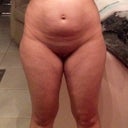 Morning of surgery @ 141 lbs