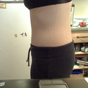 side view still swollen :( getting better