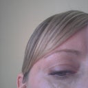 This was after treatment and this was one of many lumps.