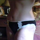 Tummy tuck 10 weeks post op