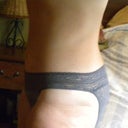 6 months post OP