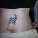 Day 4, post op
