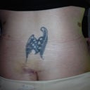 Day 4, post op