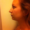 Before profile
