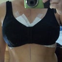Day 1 post op with bra and bandages