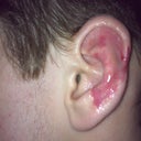 They are a little oily from the Scar Fade cream