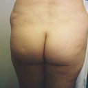 before full view