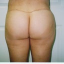 after full view
