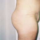 before side view