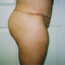 after side view