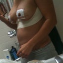 i'm not sure what all that tape is all about but the doctor said to keep it on until sunday