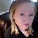 Day after the chemical peel
April 12th