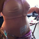 without binder.. 2 days post op