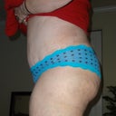 18 days post op